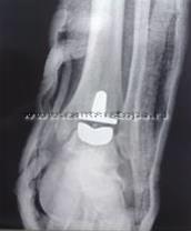 11032010591.jpg