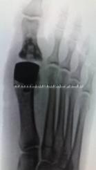 30092010812.jpg