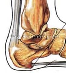 http://www.physio-med.ru/images/stories/Physioimages/shpora.jpg